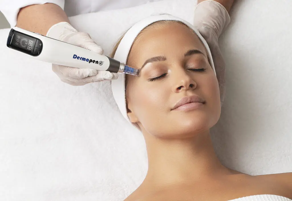 Dermapen microneedling treatment